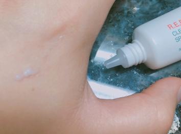 레드 블레미쉬 클리어 수딩 스팟 밤 30ml